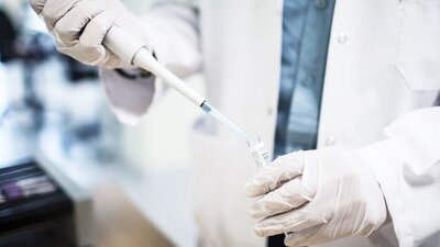 Kan tahlilinden kanser teşhisi konulacak