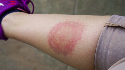 "Hastalar kandırılıyor! 2-3 yılı bulan gereksiz antibiyotik tedavisi veriliyor..."