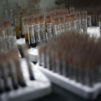 Otizm tanısında yapay zeka dönemi