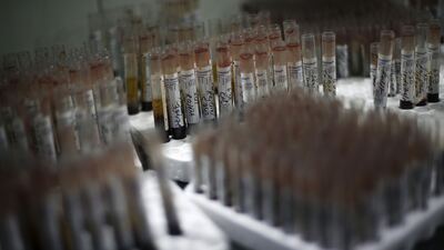 Otizm tanısında yapay zeka dönemi