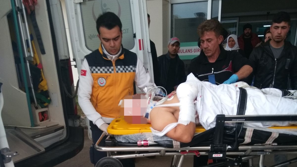 Torpille oynayan izinli asker gözünü ve parmaklarını kaybetti