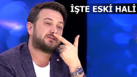 "Estetik yaptırdım, reklam hayatım bitti"