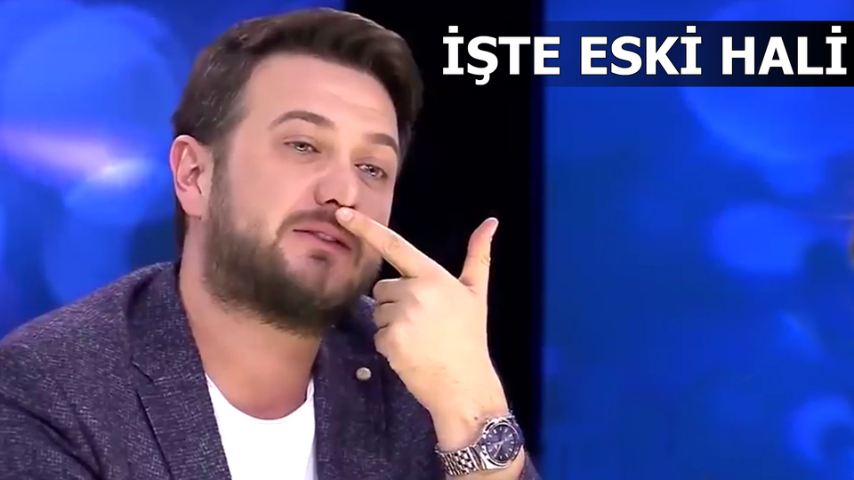 "Estetik yaptırdım, reklam hayatım bitti"