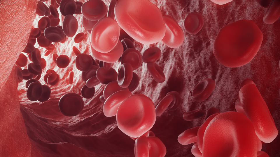 Sık görülen baş dönmesi şah damarı tıkanıklığı olabilir