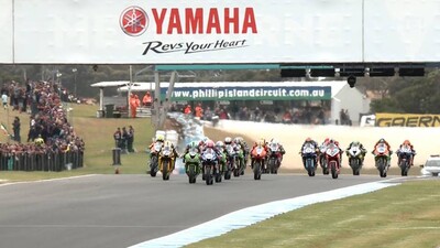 Kenan Sofuoğlu ameliyat olmayacak