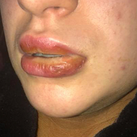 Onu bu hale getiren silikon değil! O ürünü neredeyse her kadın kullanıyor!