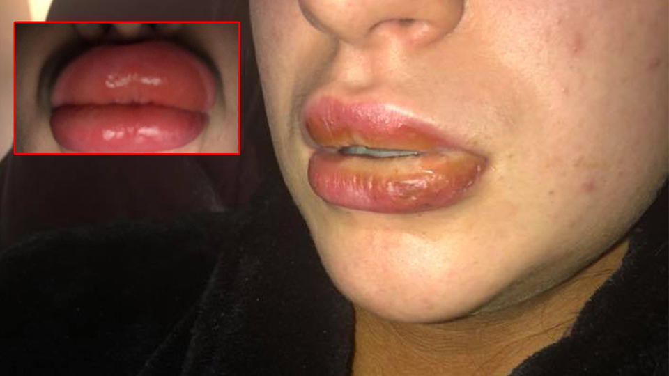 Onu bu hale getiren silikon değil! O ürünü neredeyse her kadın kullanıyor!