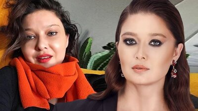 Nurgül Yeşilçay'dan botoks açıklaması