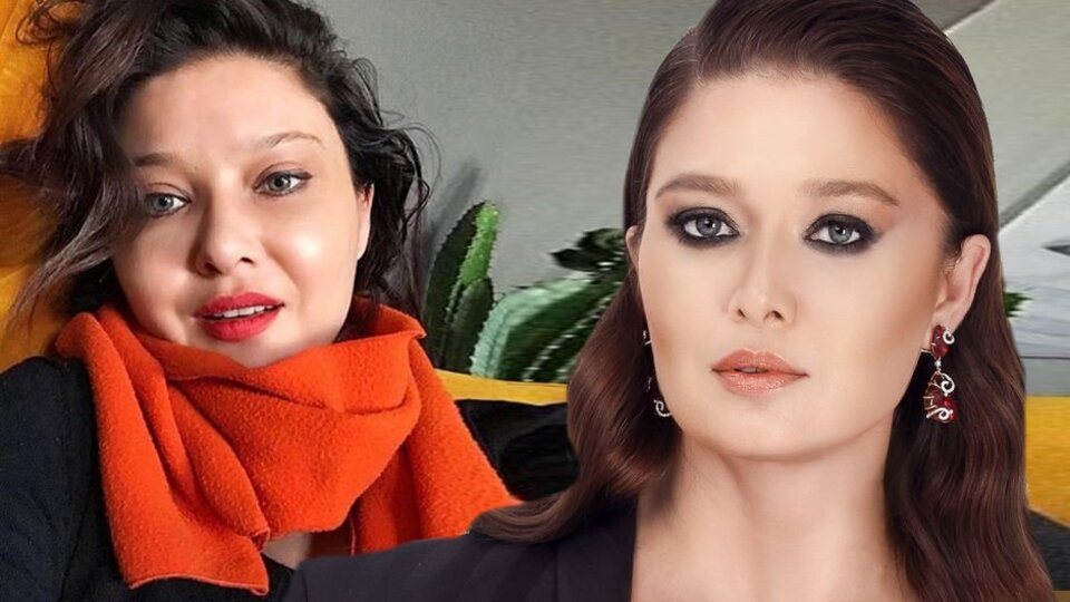 Nurgül Yeşilçay'dan botoks açıklaması