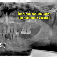 Dişini çektirmeye gitti, başına öyle bir şey geldi ki...