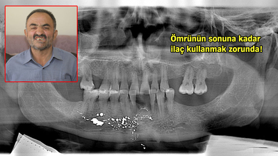Dişini çektirmeye gitti, başına öyle bir şey geldi ki...