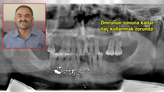Dişini çektirmeye gitti, başına öyle bir şey geldi ki...
