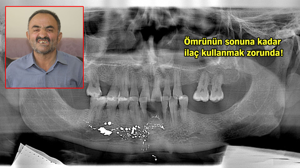 Dişini çektirmeye gitti, başına öyle bir şey geldi ki...