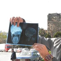 Beyninden çıkan şeye inanamayacaksınız!