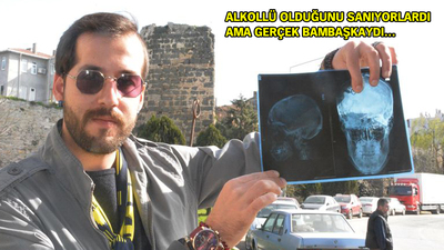 Beyninden çıkan şeye inanamayacaksınız!