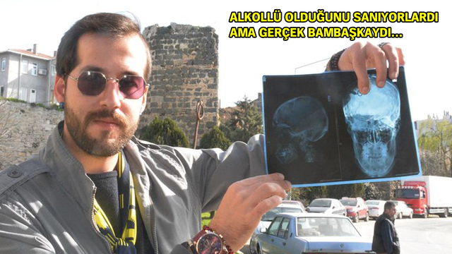 Beyninden çıkan şeye inanamayacaksınız!