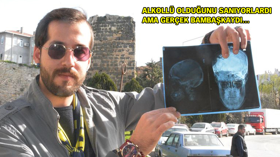 Beyninden çıkan şeye inanamayacaksınız!