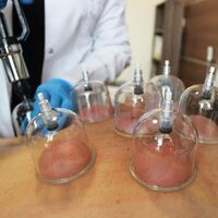 Hastanelerde hacamat dönemi!