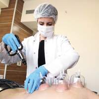 Hacamat uzmanları böldü