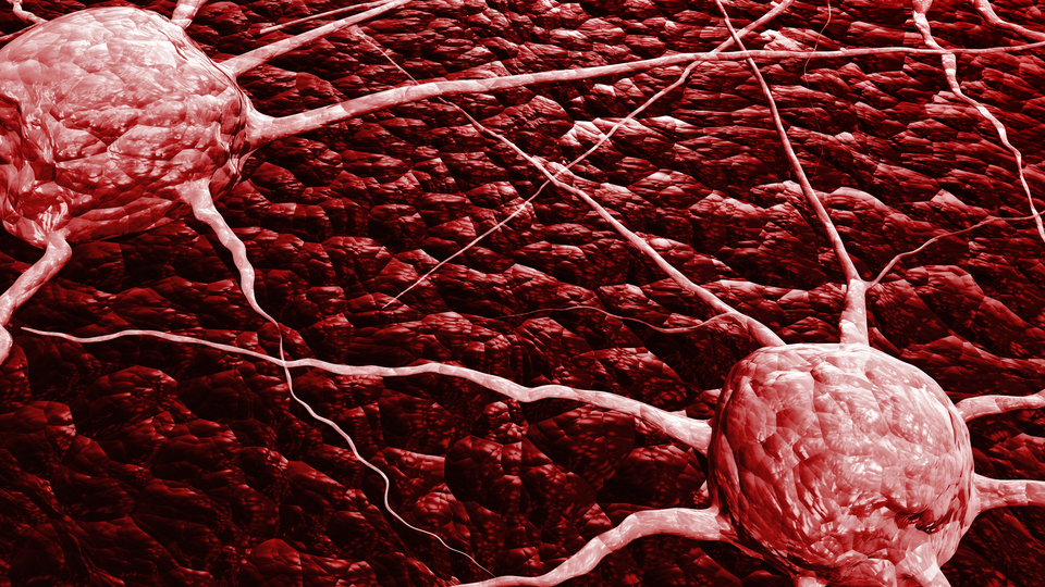 Kanserde elektrokinetik biyoçip teknolojisi!