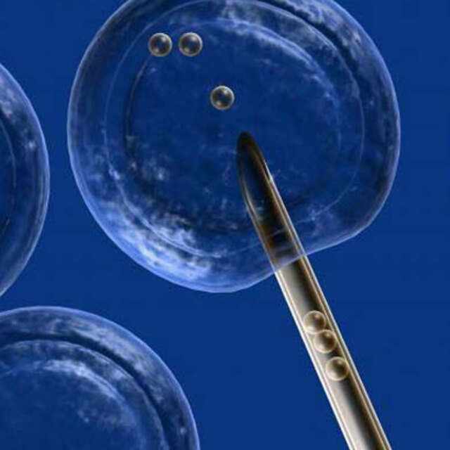 Mikroçip ile evde sperm testi