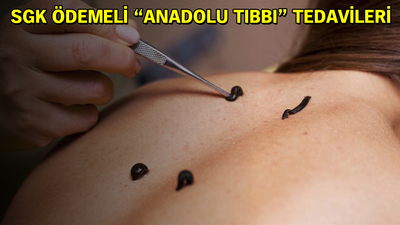 Aile hekimine sülük teşviki