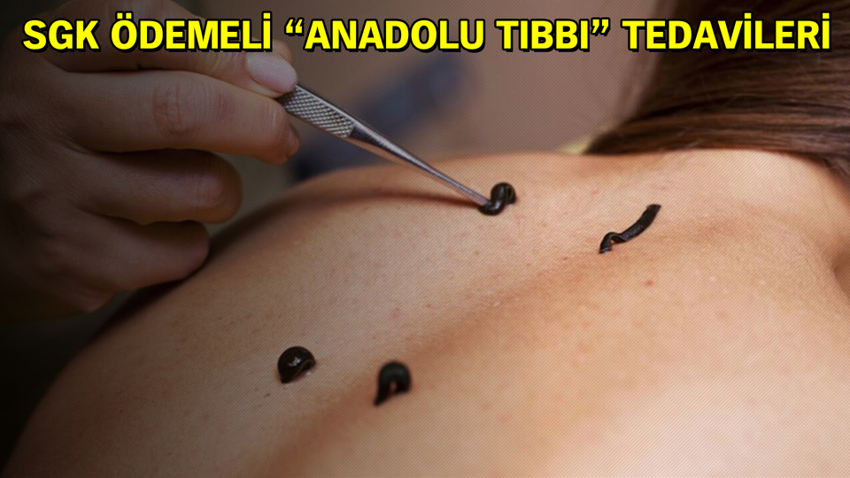 Aile hekimine sülük teşviki