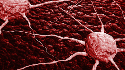 'Kanser artık grip gibi oldu' cümlesi yanlış!