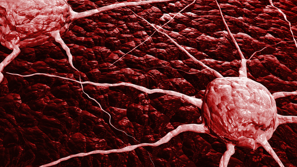 'Kanser artık grip gibi oldu' cümlesi yanlış!