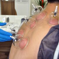 Hacamat yaptırırken nelere dikkat edilmeli?