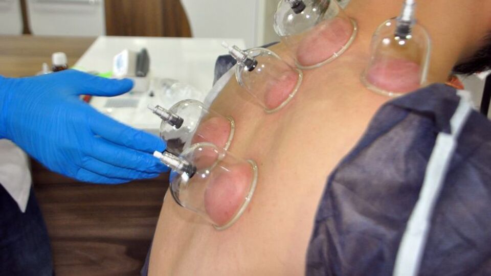 Hacamat yaptırırken nelere dikkat edilmeli?