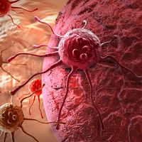 Sigaradan sonra kanser yapan ikinci nedene inanamayacaksınız!