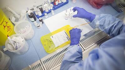 Türkiye, kanser tanısı ve tedavisinde hangi noktada?