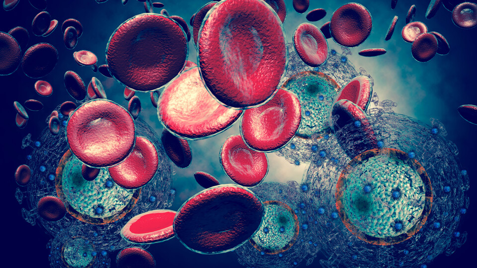 İnsülin direnci kanseri tetikliyor!