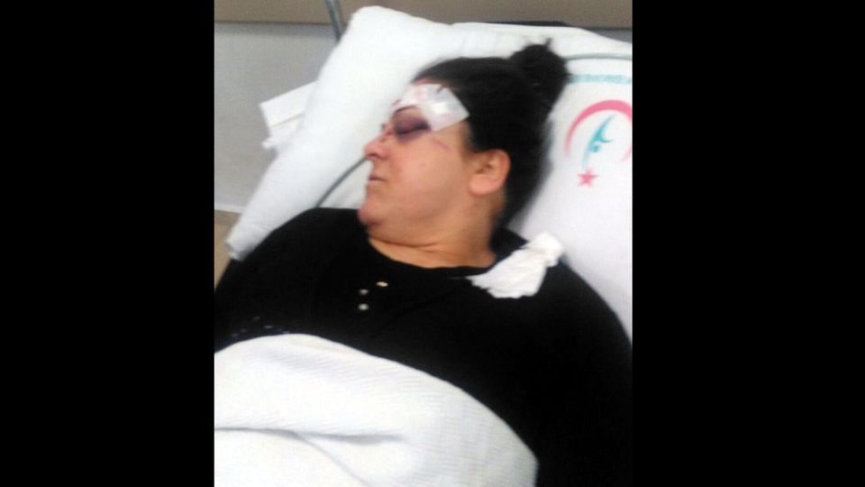 Korkunç! Sokakta tornavidayla saldırdı