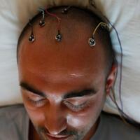 Epilepside nöbet uyarısı