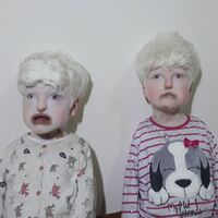 Mardinli kız kardeşler hem albino hem de duyma ve konuşma engelli...