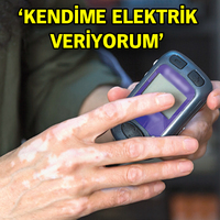 Üniversite hastanesinde ağrı pili dönemi