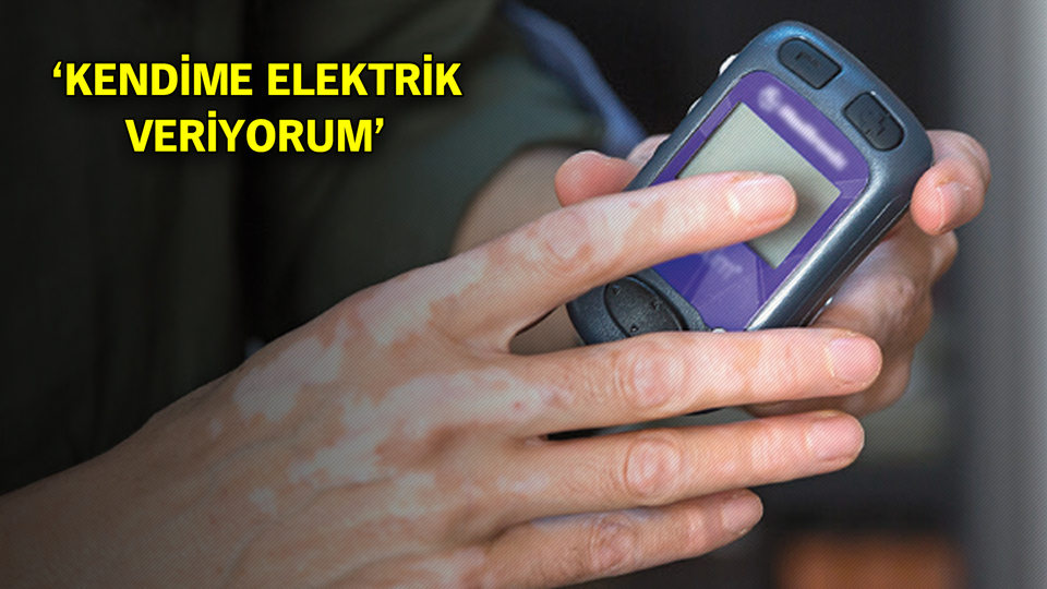 Üniversite hastanesinde ağrı pili dönemi