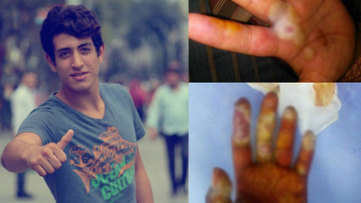 Tespih sandığı radyoaktif maddeye dokundu... Sonrası korkunç!