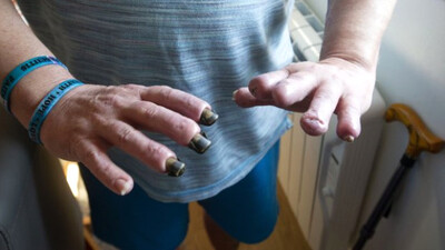 Sadece çocuklarıyla oyun oynuyordu! Güllerin üzerine düşen adamın parmakları kesildi!