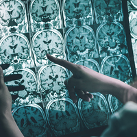 Bilim insanları Alzheimer'ın en büyük düşmanını açıkladı!