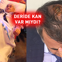 Güneş'e müdahale eden doktor konuştu!