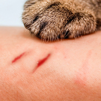 Kedi tırmaladı, talihsiz kadının göğsü birdenbire çürümeye başladı!