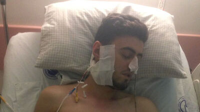 Düğünde maganda kurşununun hedefi oldu, vuran kişi serbest kaldı