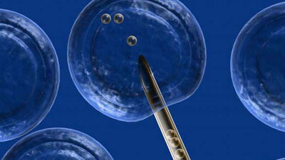 Sperm detoks yöntemi nedir?