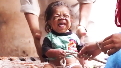 Bebek vücudunda 23 yıl!