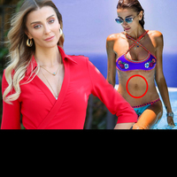 "Özge Ulusoy'un göbek deliği lens mi?"