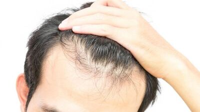 Saç ekiminde 'AIDS' tehlikesi