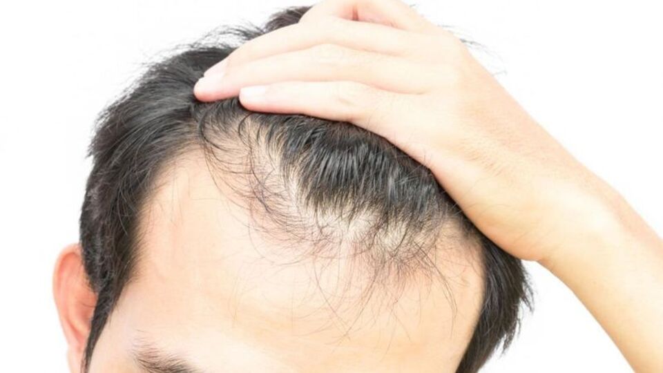 Saç ekiminde 'AIDS' tehlikesi